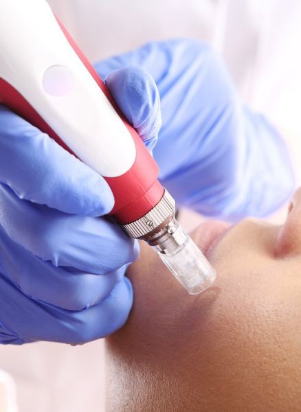 Derma Pen
